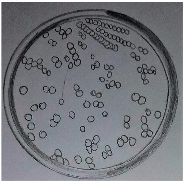 Khuẩn lạc vi khuẩn trên sơ đồ đĩa petri